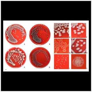e.coli